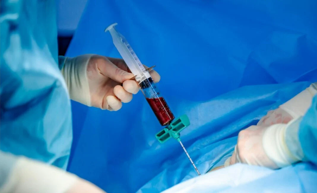 RN chega a mais de mil doadores de medula óssea