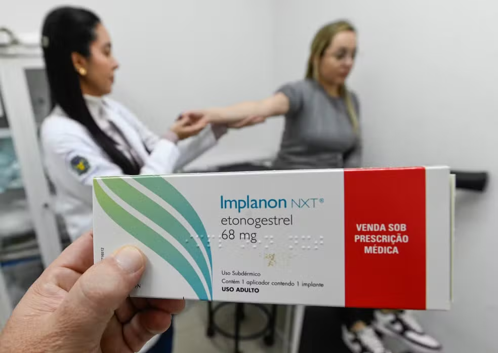 Planos de saúde passam a cobrir implante contraceptivo Implanon