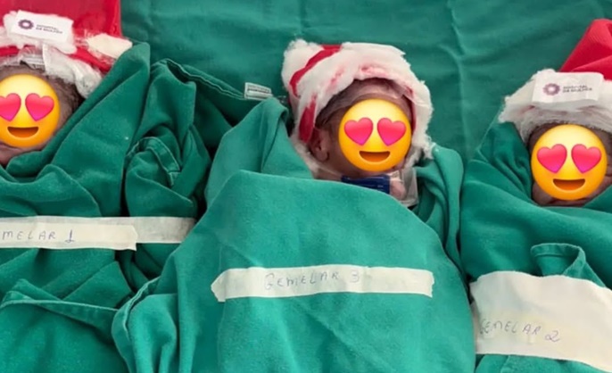 Hospital da Mulher registra primeiro nascimento de trigêmeos