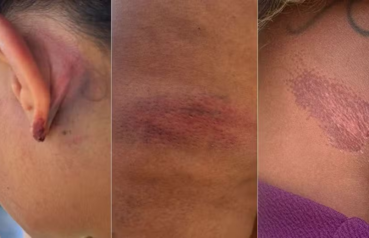 PM afasta policiais após denúncia de agressão a advogada no RN