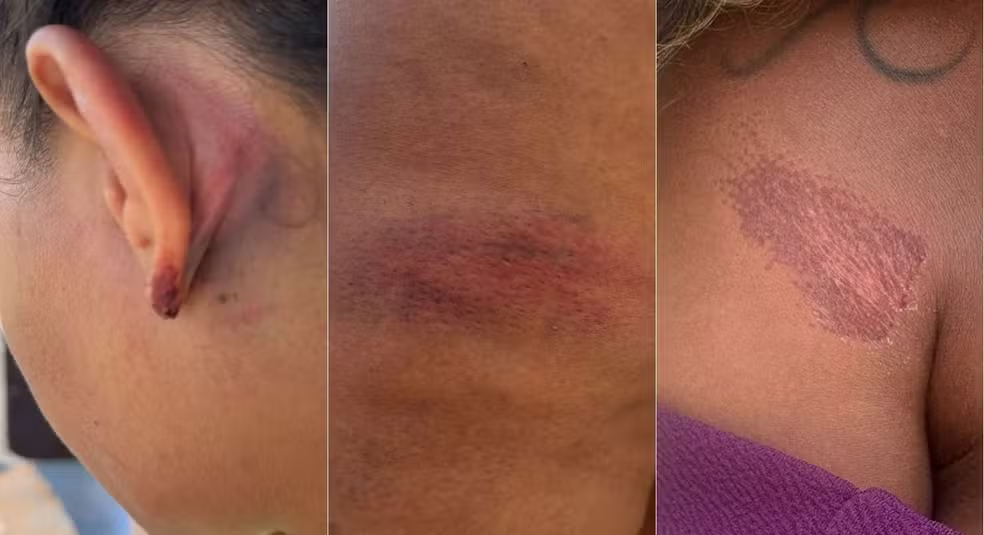 PM afasta policiais após denúncia de agressão a advogada no RN