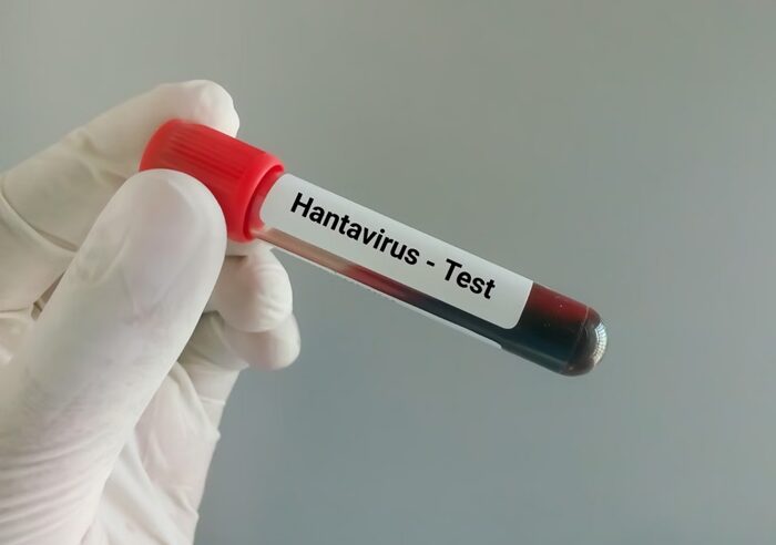 RN não registra casos de hantavírus há 27 anos, diz Sesap