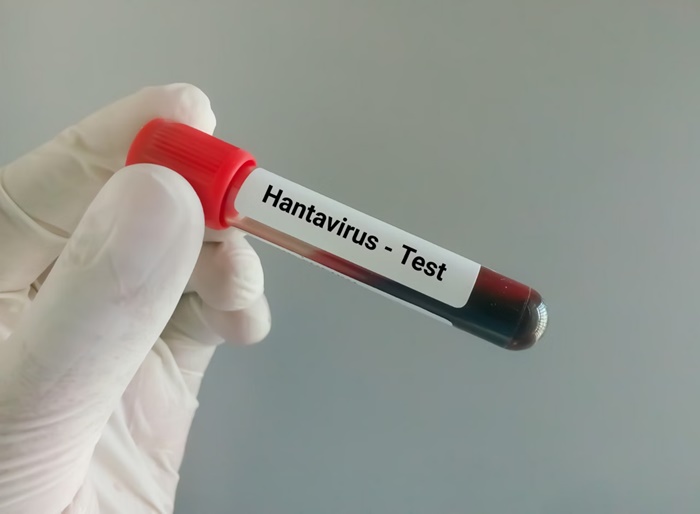 RN não registra casos de hantavírus há 27 anos, diz Sesap