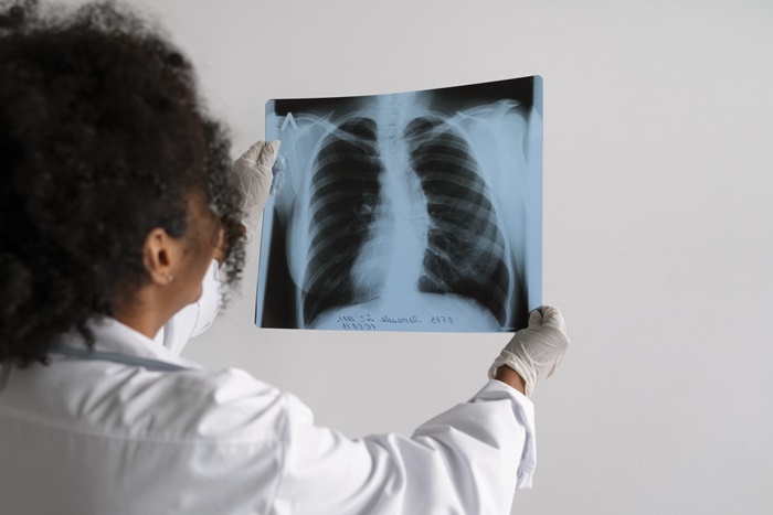 Anvisa aprova novo remédio contra câncer de pulmão avançado